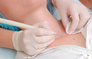 A zsírszövet megjelenésének okai a bőr alatt és azok kezelési módjai