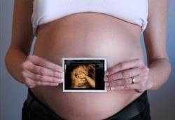 De ce este necesar să faci 3d uzi în timpul sarcinii, diferențele, avantajele și dezavantajele acesteia