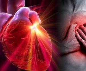 6 Remedii naturale pentru prevenirea atacului de cord - medicină 2