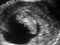 7 săptămâni de sarcină - dimensiunea fetală