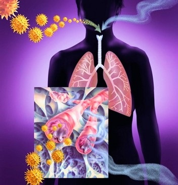 Hordó-alakú mellkas és a tüdőemfizéma
