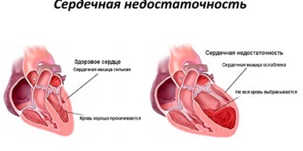 Durerea sub coastele care dau în spate - de ce apare și cum se luptă cu ea