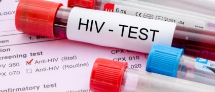 A HIV-fertőzés nyomása, mit tegyenek, tüneteket