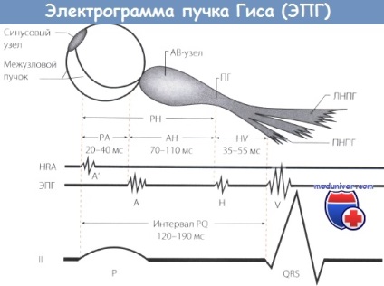 Sistemul electrofiziologic al inimii