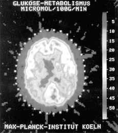 Dacă ați uitat să opriți fierul, acesta poate fi văzut pe radiografia, știința și viața