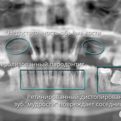 Fotografii înainte și după vizitarea stomatologiei profesoriale - secolul 22, tratamentul stomatologic galerie foto,
