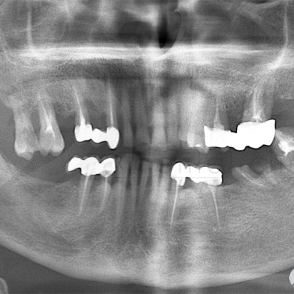 Fotografii înainte și după vizitarea stomatologiei profesoriale - secolul 22, tratamentul stomatologic galerie foto,