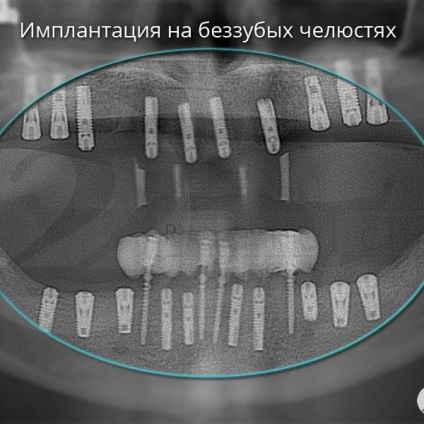 Fotografii înainte și după vizitarea stomatologiei profesoriale - secolul 22, tratamentul stomatologic galerie foto,