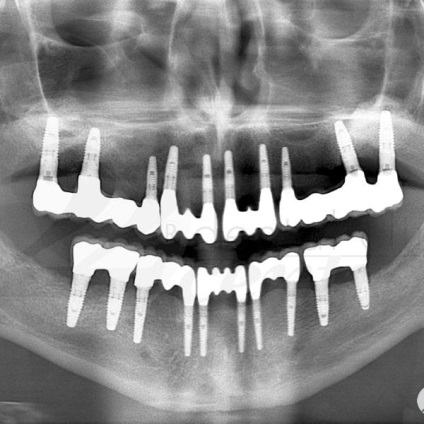 Fotografii înainte și după vizitarea stomatologiei profesoriale - secolul 22, tratamentul stomatologic galerie foto,