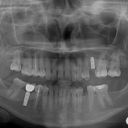 Fotografii înainte și după vizitarea stomatologiei profesoriale - secolul 22, tratamentul stomatologic galerie foto,