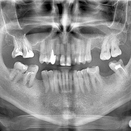 Fotografii înainte și după vizitarea stomatologiei profesoriale - secolul 22, tratamentul stomatologic galerie foto,