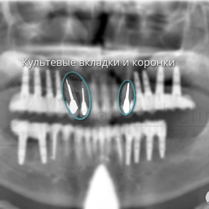 Fotografii înainte și după vizitarea stomatologiei profesoriale - secolul 22, tratamentul stomatologic galerie foto,