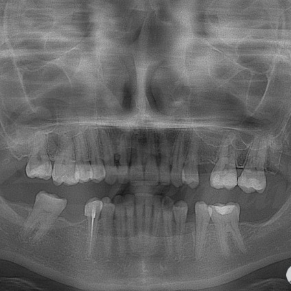 Fotografii înainte și după vizitarea stomatologiei profesoriale - secolul 22, tratamentul stomatologic galerie foto,