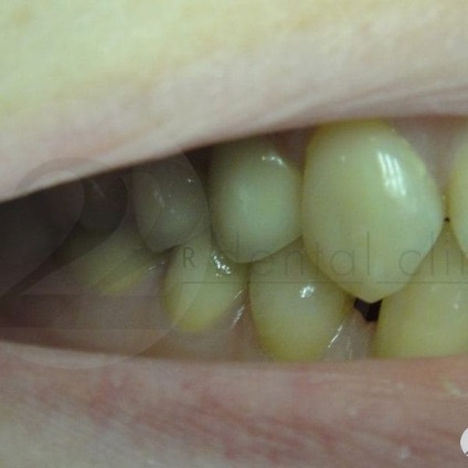 Fotografii înainte și după vizitarea stomatologiei profesoriale - secolul 22, tratamentul stomatologic galerie foto,