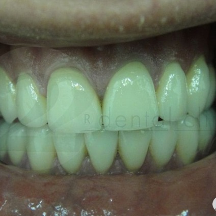 Fényképek utazás előtt és után a professzor fogászat - 22 században, fogászat galéria