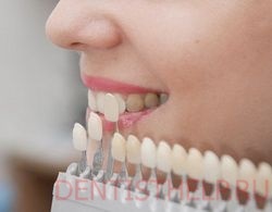 Modificarea culorii dintelui; galben și dinți gri ce să facă; placă galbenă pe tratamentul dinților din mosc