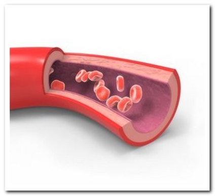 Medicamentele vasodilatatoare utilizate pentru osteochondroză