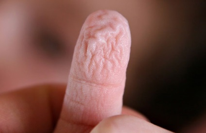Cum să salvați degetele zdrobite