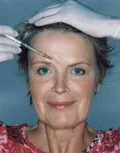 Cum se elimină ridurile de la frunte - îngrijirea facială adecvată - un catalog de articole - cum să fii frumos