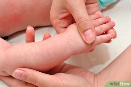 Cum să știți ce să așteptați de pe pielea nou-născutului