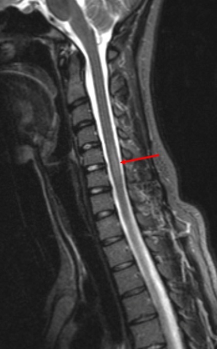 MRI gerinc Naberezhnye Chelny