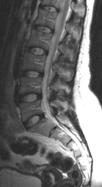 MRI gerinc Naberezhnye Chelny