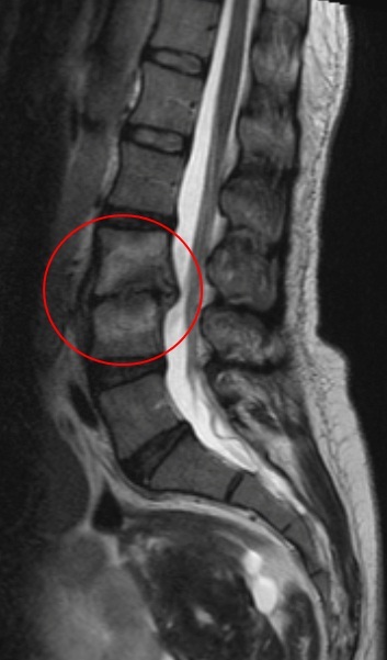 MRI gerinc Naberezhnye Chelny