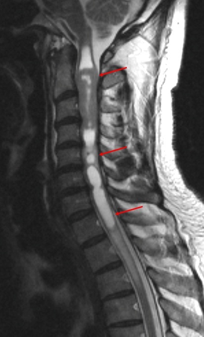 MRI gerinc Naberezhnye Chelny