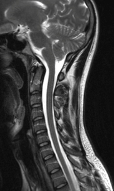 MRI gerinc Naberezhnye Chelny