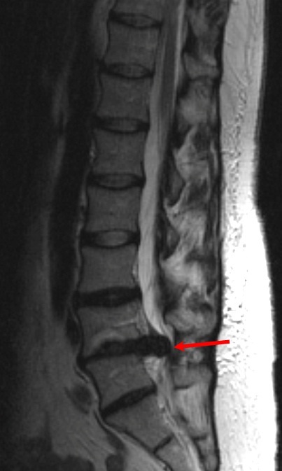 MRI gerinc Naberezhnye Chelny