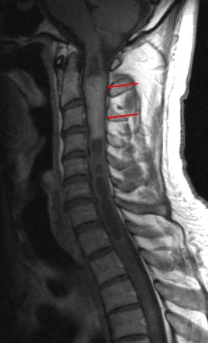 MRI gerinc Naberezhnye Chelny