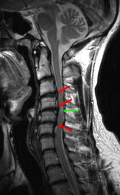 MRI gerinc Naberezhnye Chelny