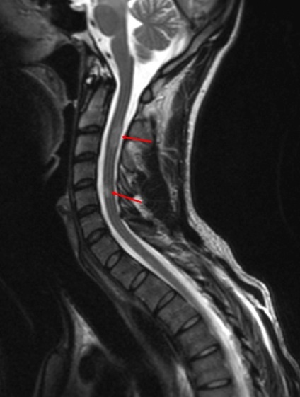 MRI gerinc Naberezhnye Chelny