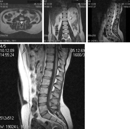 MRI gerinc Naberezhnye Chelny, Avicena 1