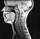 MRI gerinc Naberezhnye Chelny, Avicena 1