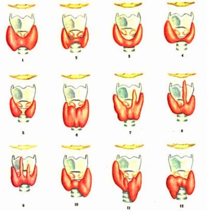 Care sunt rezultatele ecografiei tiroidiene?