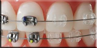 Stomatologie ortodontică