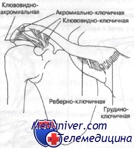 Fractura de clavicula