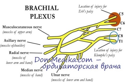Leziuni la nastere ale craniului, diagnoza plexului brahial, tratament