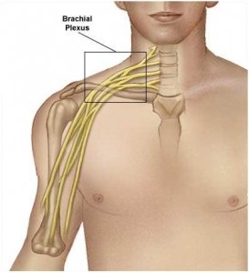 Plexita cervicală - o leziune a plexurilor nervoase din regiunea cervicală