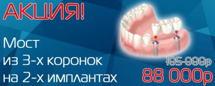 Stomatologie konkovo ​​- vizită dentară