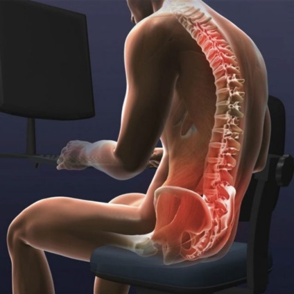 Exerciții de la dureri de spate (stil de viață sedentar) Exerciții pentru dureri de spate scăzute
