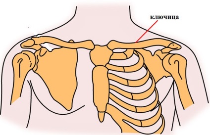 Dislocarea inelelor de tratament ale claviculei și a anvelopelor medicale