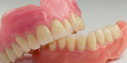 Dentar sandwich de proteze dentare de material elastic - caracteristici și dezavantaje ale noului