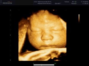 3D uzi în timpul sarcinii preț, diferențe în cost, posibilitatea de a primi fotografii și clipuri video