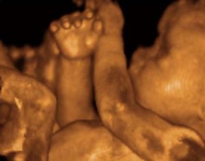 3D uzi în timpul sarcinii preț, diferențe în cost, posibilitatea de a primi fotografii și clipuri video