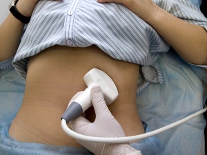 Anevrismul aortei cavității abdominale diagnosticarea precoce și operarea în timp util - garantarea sănătății