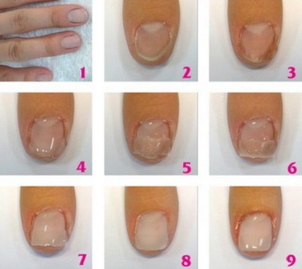 Bioarmificarea unghiilor