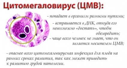 A citomegalovírus gyermekeknél a tünetek és a kezelés a betegség