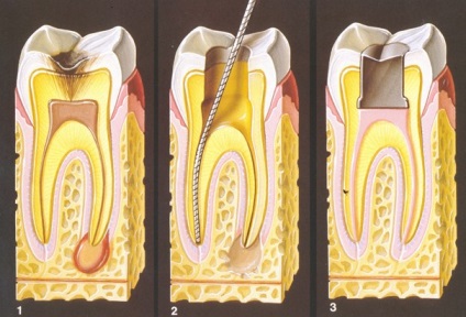 Disponibil pentru tratamentul canalelor, perfectsmile